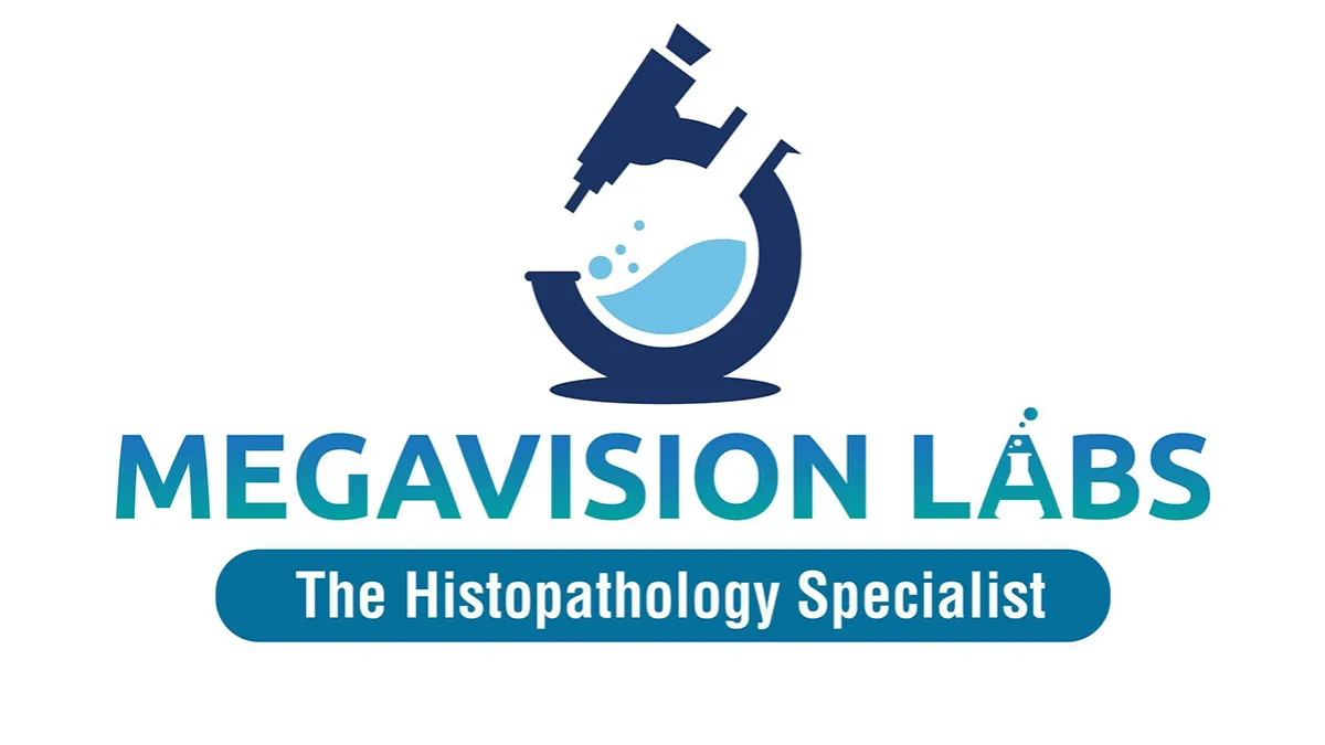 Megavision Labs Pvt Ltd 1